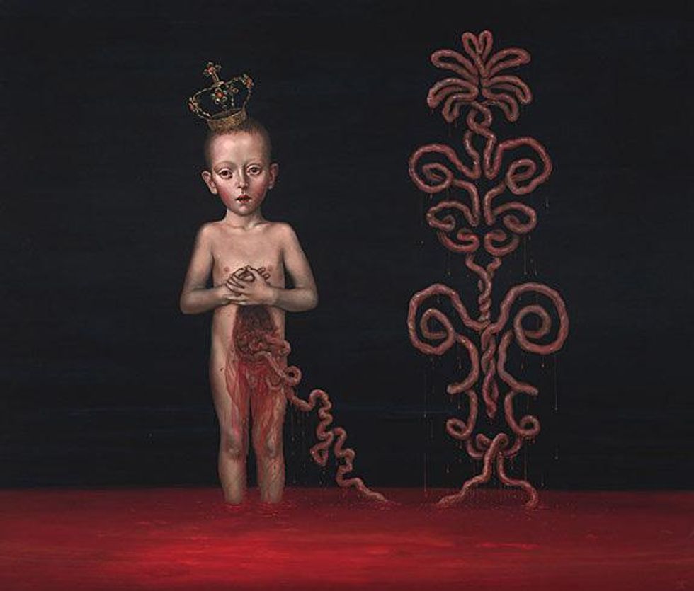 07_umbilical-carouchex633