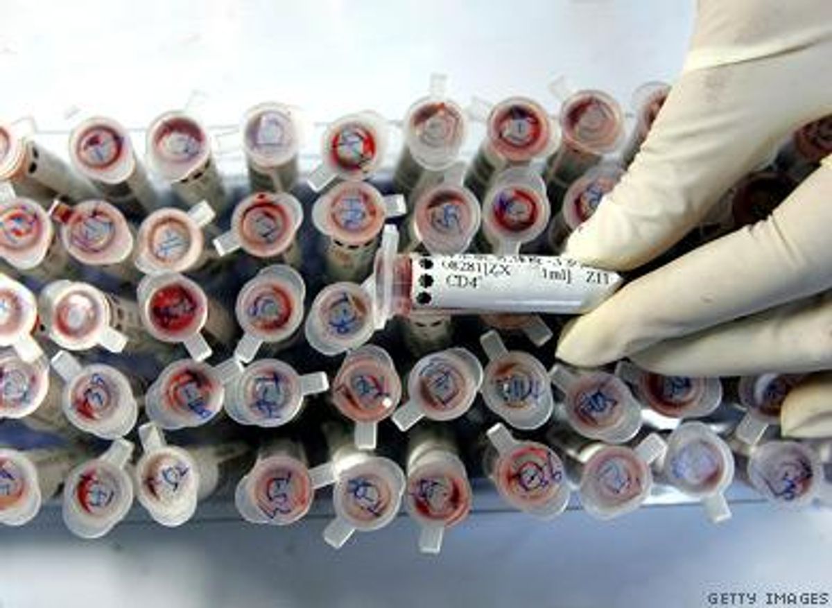 Stem Cell Transplant Patient Free of HIV