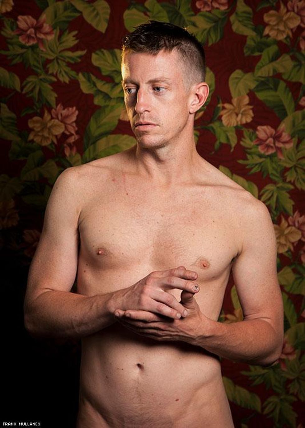 Andy With Bruised Nail