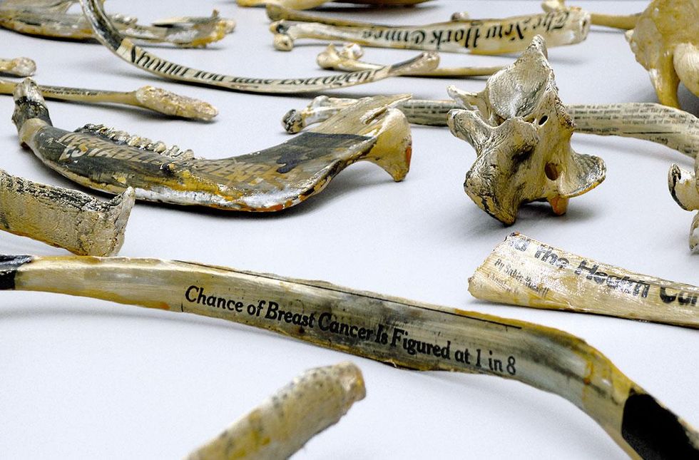 Barbara Hammer. Cancer Bones, 1994