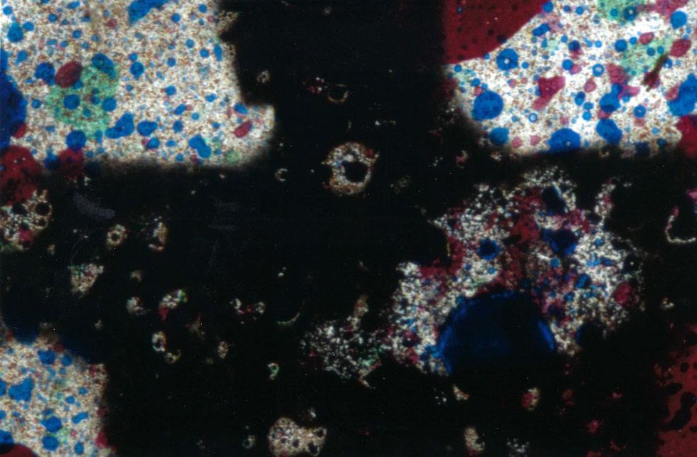 Barbara Hammer. Chest X-ray 18, 2015