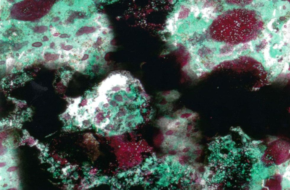 Barbara Hammer. Chest X-ray 6, 2015