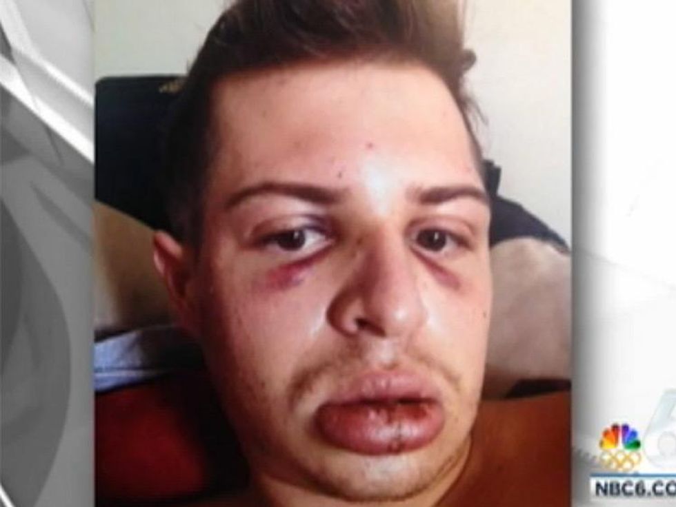 Burger King Attack in Miami Beach