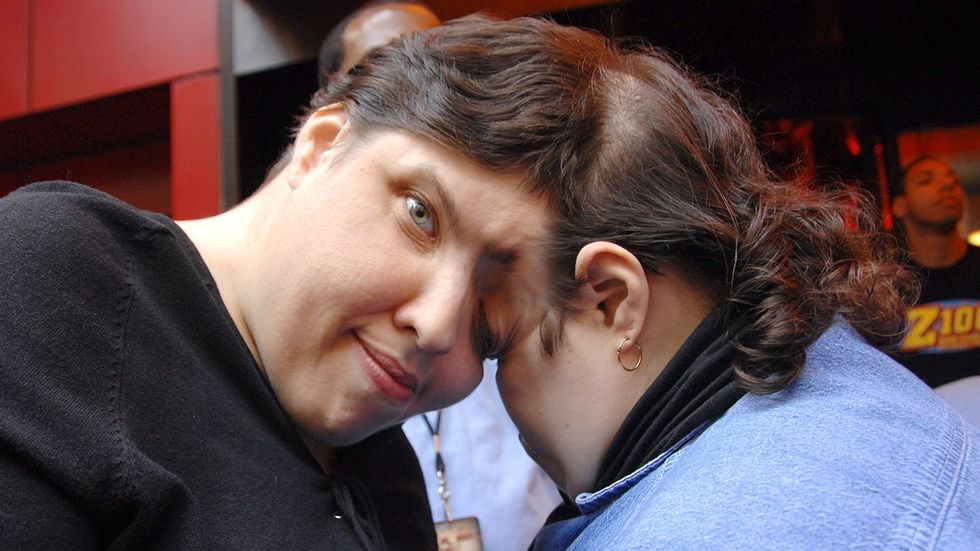 Conjoined twins Lori Schappell trans man George Schappell