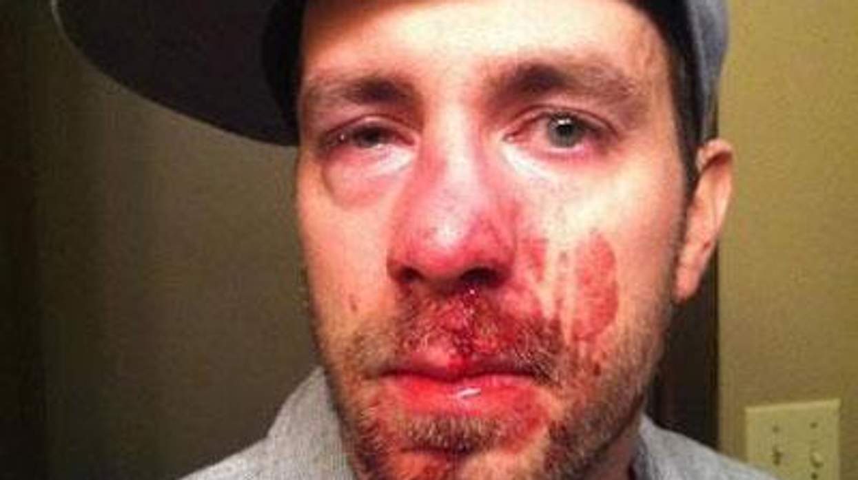 Drew-bartscher-400x400-lead