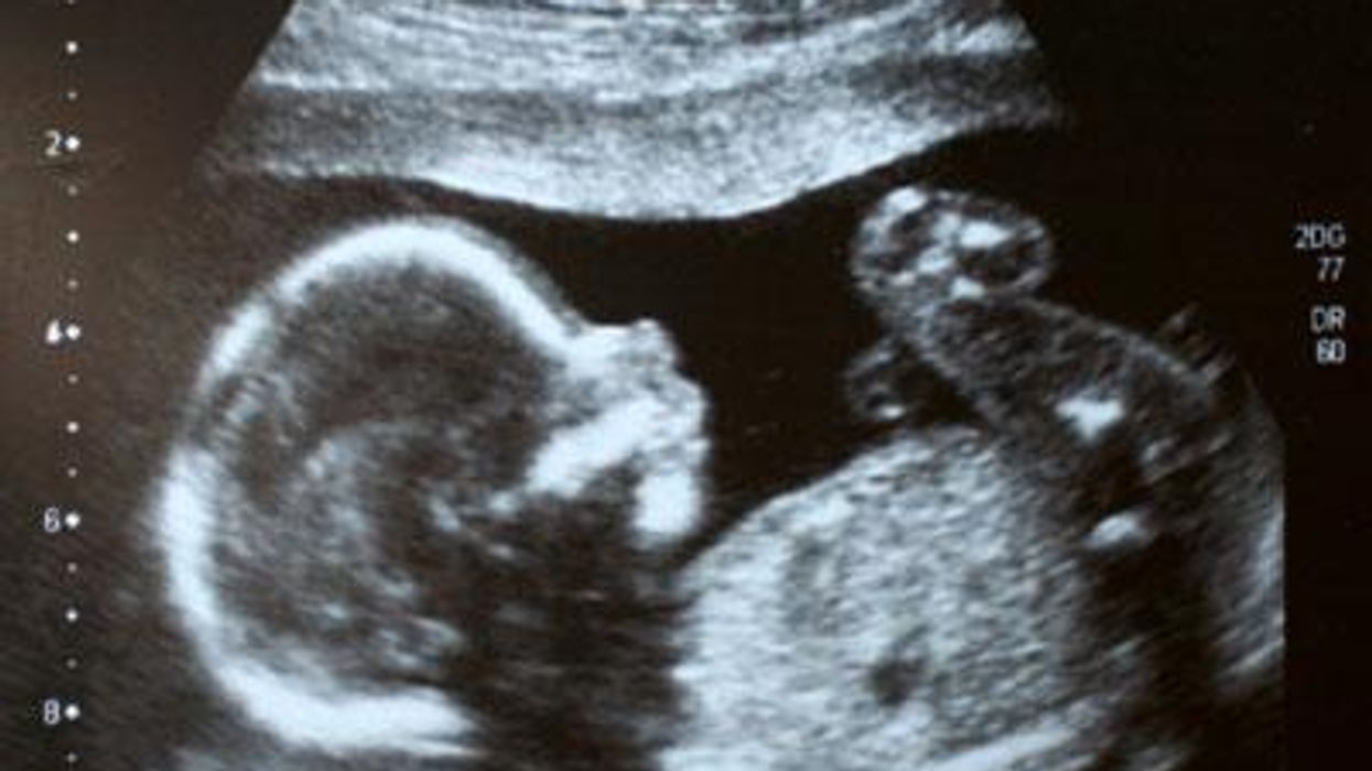 Euterobabyx400_advocate_0