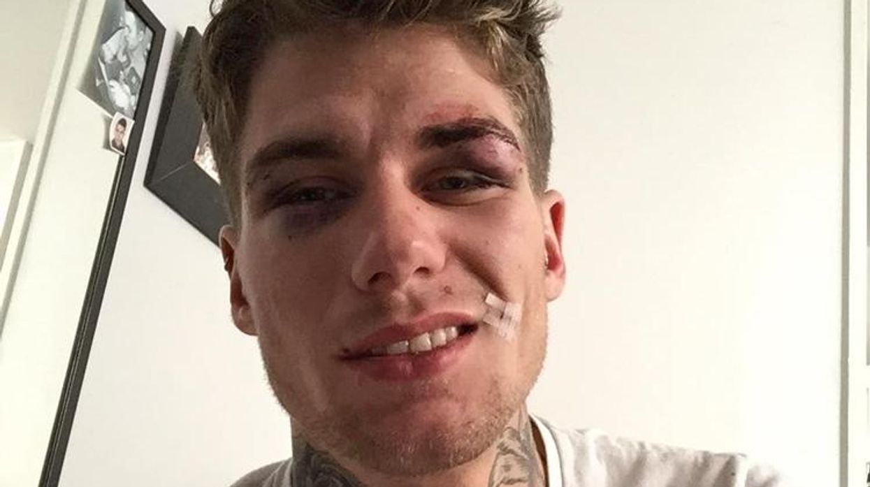 Facebook/Clement Grobotek