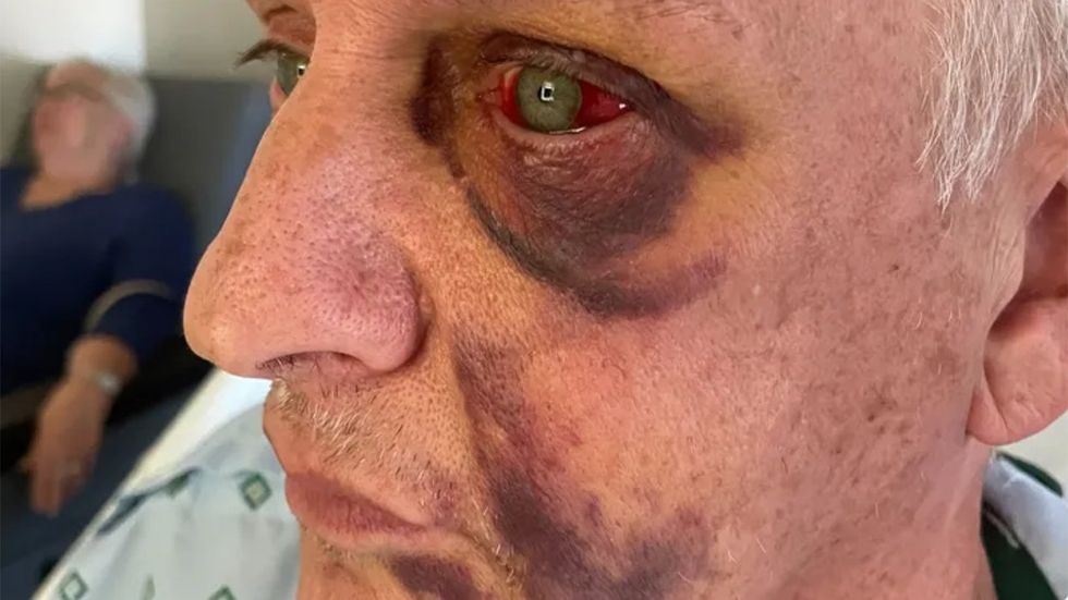 Florida Man Attacked by Two Men Yelling Anti-Gay Slurs Needs Your Help