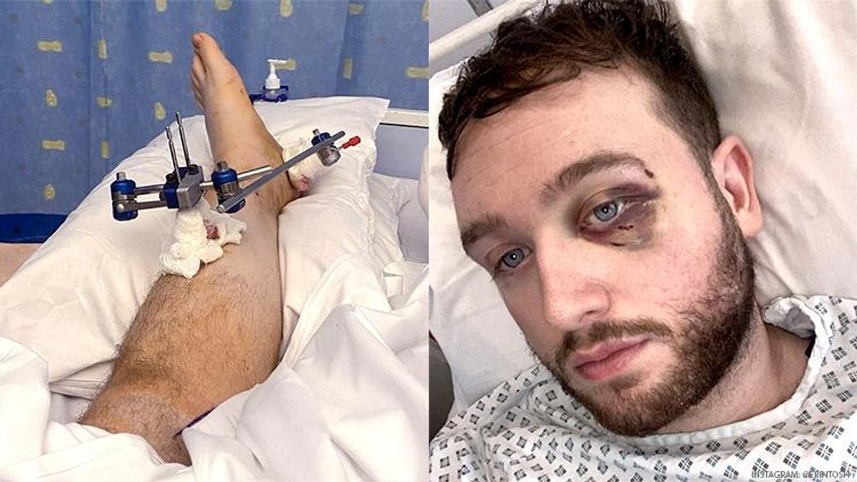 Gay Irish Rugby Player Evan Somers, 24, Beaten So Badly He May Never Play Sport Again