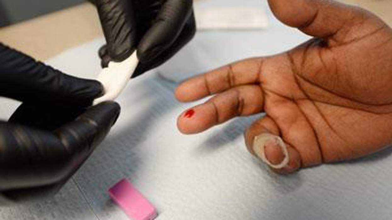 Hiv-blood-test-x400