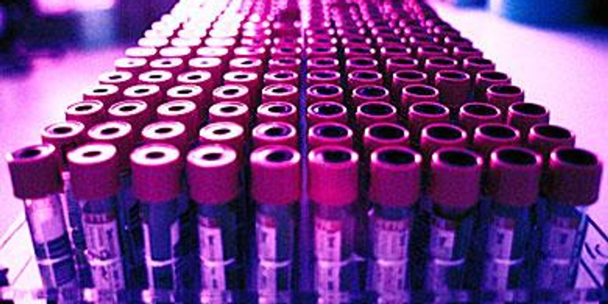 Human Tested Human Testing on Possible HIV Vaccine Starts in Jan | Advocate.com