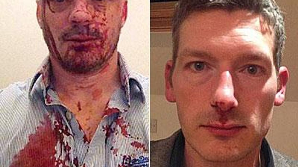Editor of Gay Website Beaten in London
