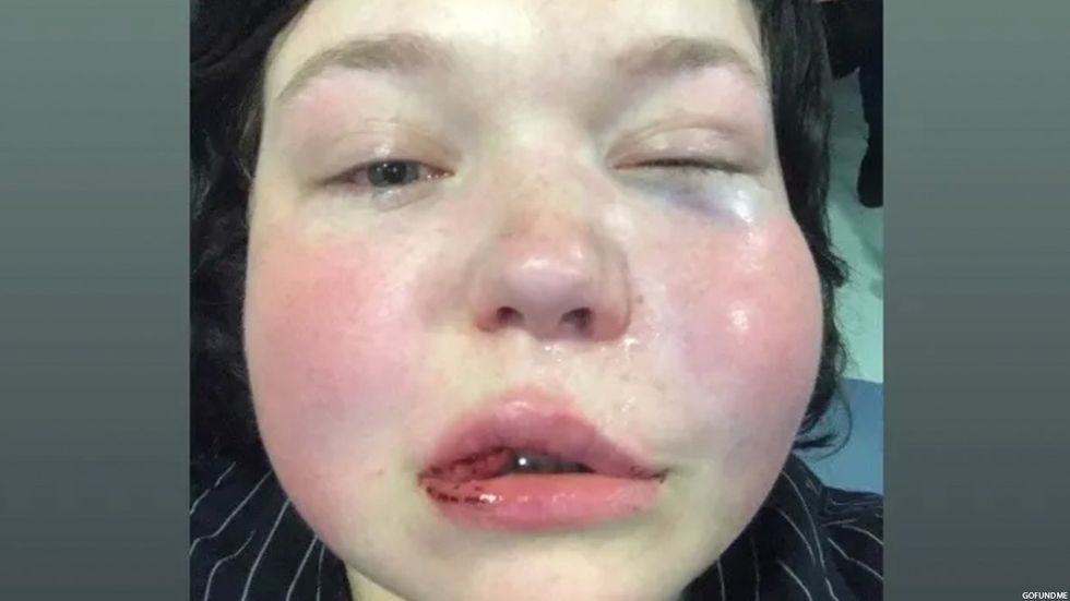 Irish Teen Pleads Guilty to Brutal Attack on Lesbian Couple