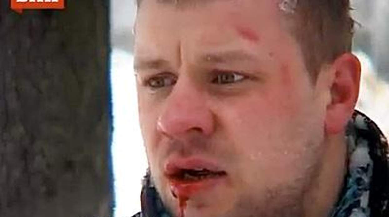 Kalininbeatenbigx400