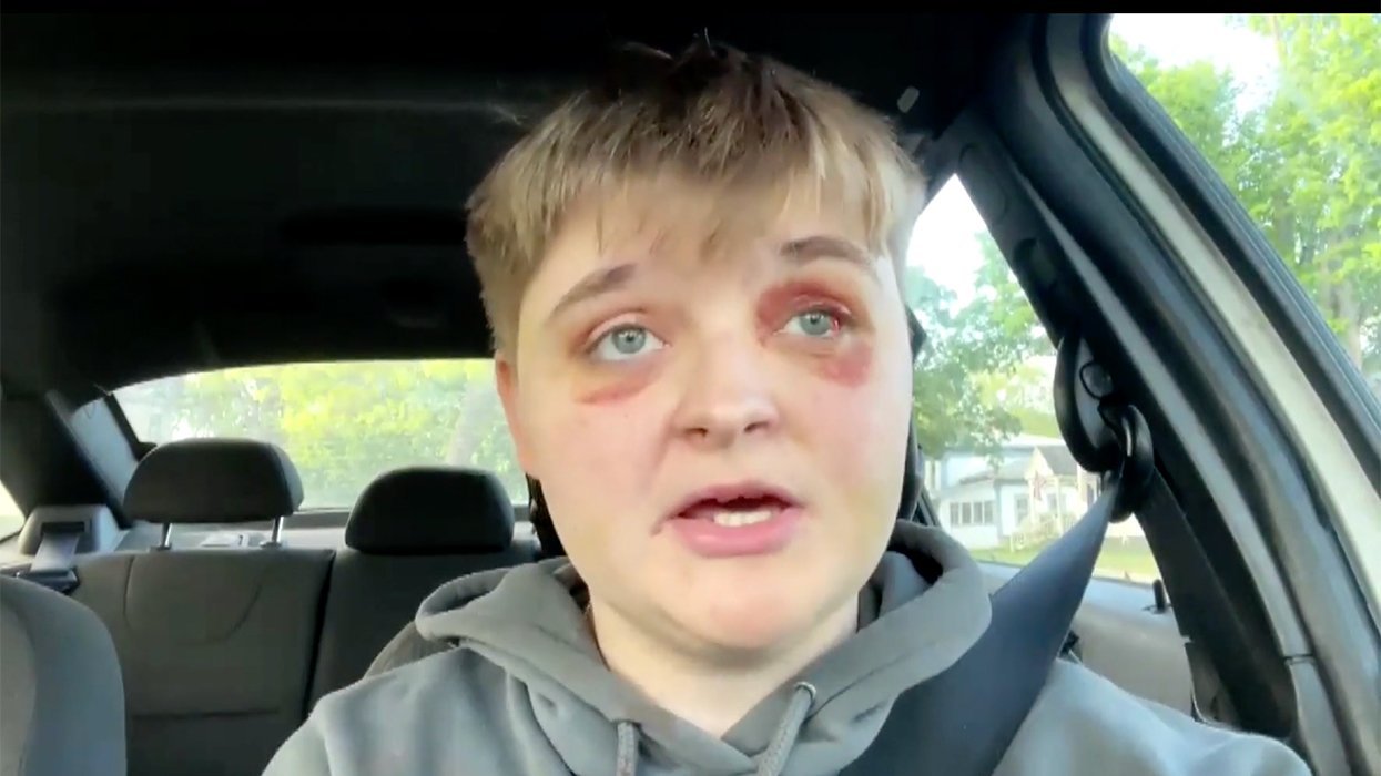 Hun Beaten Teen lesbian beaten at Illinois McDonald's