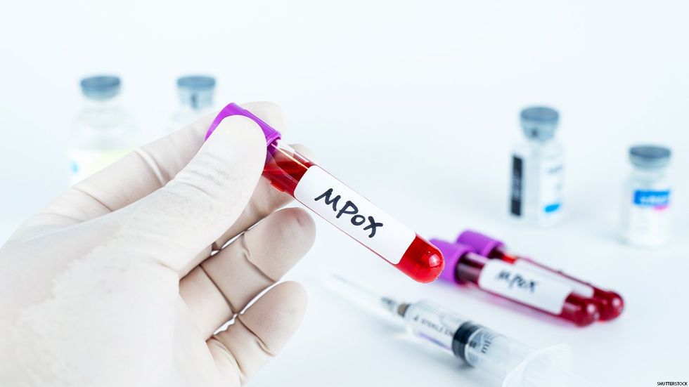 Mpox vials