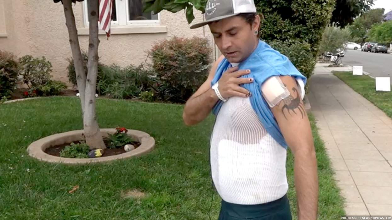 Police Say Video Proves Gay Man Burned in Despicable Attack on Pregnant Woman