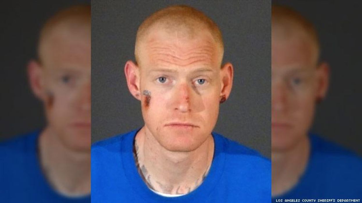 Redmond O'Neal attack