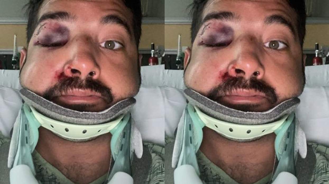 San Diego Hate Attack Victim