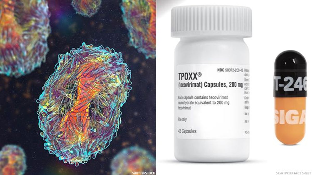 The monkeypox virus and a bottle of TPOXX.