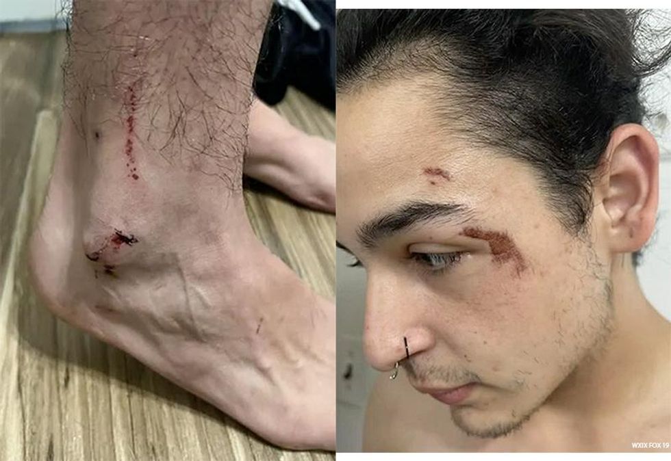 Trans Man Assaulted, Arrested For Using Women\u2019s Restroom at Campground
