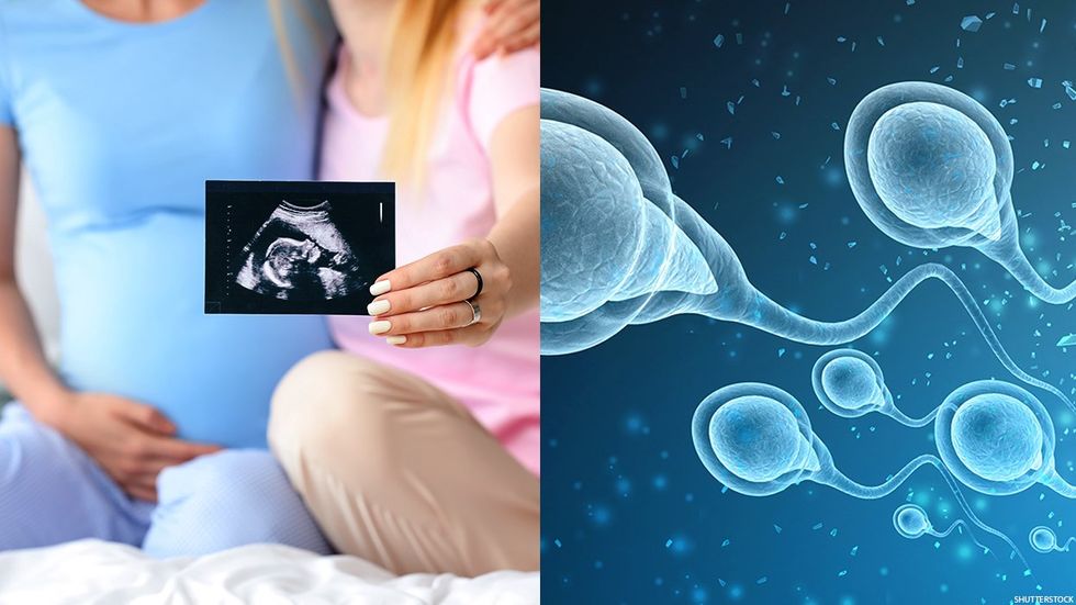 Two women, one of them pregnant holding a sonogram image next to a graphic of sperm cells.