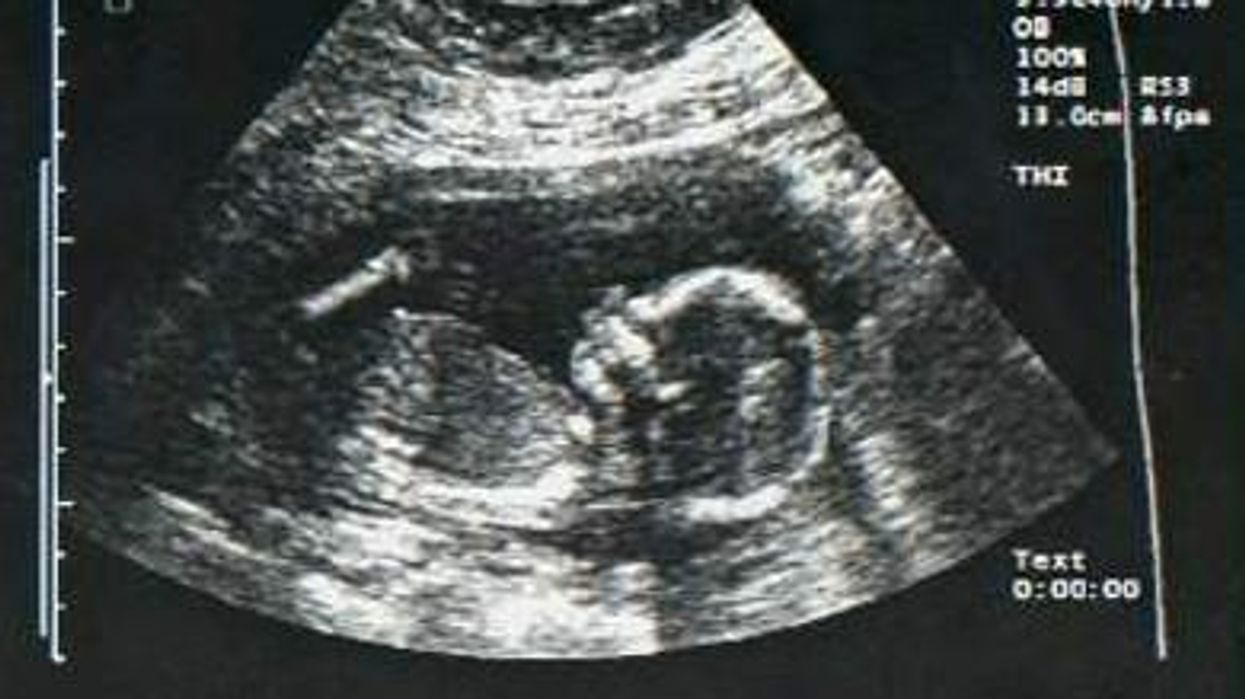 Ultrasound