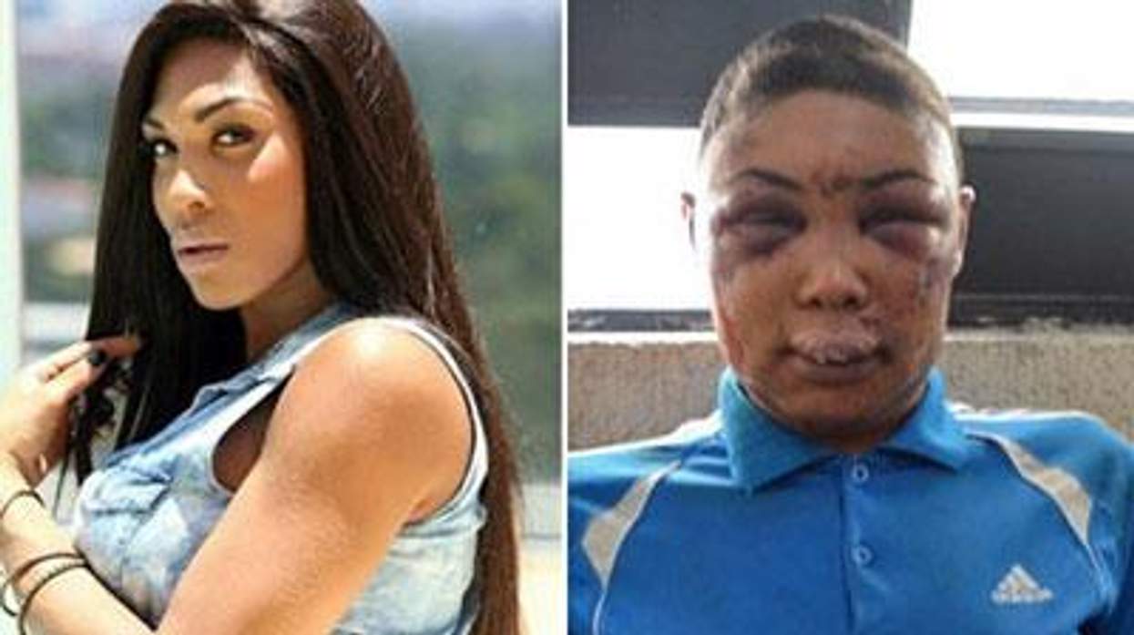 Veronica-bolina-2-x400