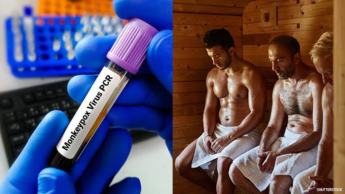 Vial with monkeypox and guys in a sauna