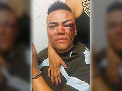 Salvadoran Trans Man Says He Was Brutalized by Police After Pride Parade
