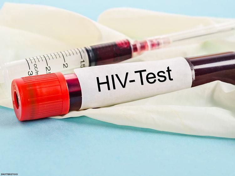 Is It Possible I Got A False Positive On My Hiv Testx750