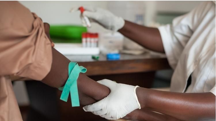 UN, World Health Org: COVID-19 May Cause 500K HIV-Related Deaths Africa