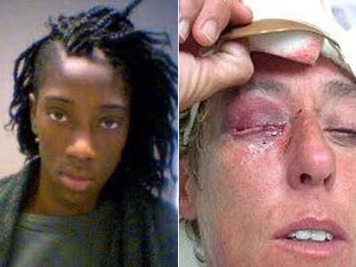 Missouri Teen Charged With Hate Crime for Lesbian Attack
