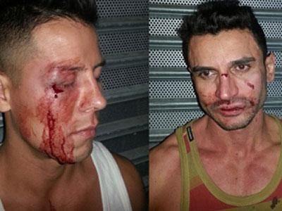 Two Arrested in Attack on Gay Men in NYC
