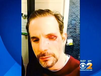 WATCH: Gay Couple Attacked in NYC on 10th Anniversary

