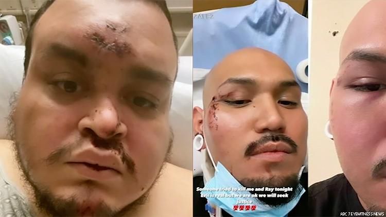 Victims of the attack