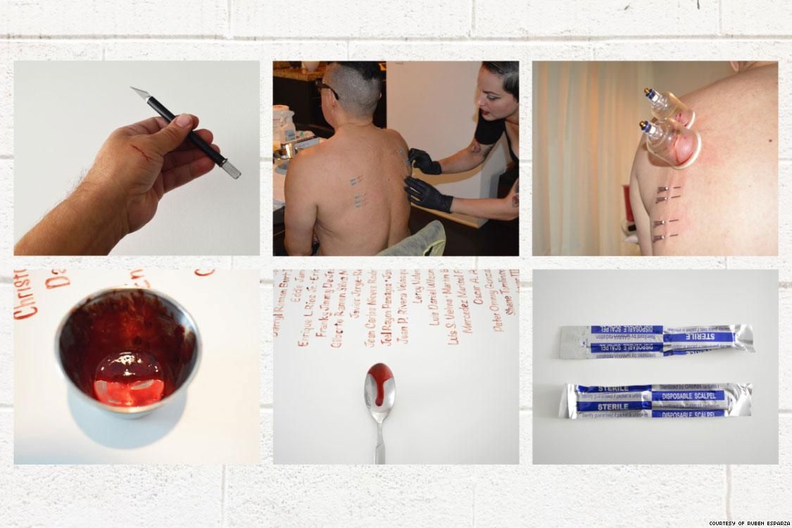 Photos of the process of drawing blood.